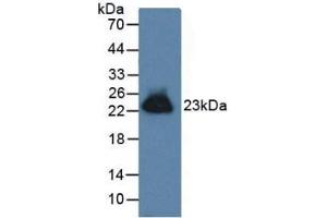 Western Blotting (WB) image for Gremlin 1 (GREM1) ELISA Kit (ABIN6730963)