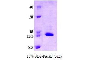 Figure annotation denotes ug of protein loaded and % gel used. (alpha Synuclein DeltaNAC (active) Protein)