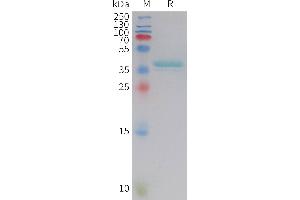 Leptin Protein (LEP) (AA 22-167) (Fc Tag)