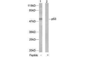 Image no. 1 for anti-Tumor Protein P53 (TP53) (Ser46) antibody (ABIN197252) (p53 antibody  (Ser46))