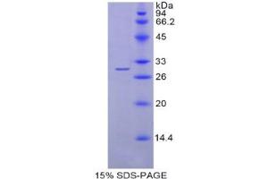 SDS-PAGE (SDS) image for Sphingosine-1-Phosphate Lyase 1 (SGPL1) (AA 239-493) protein (His tag) (ABIN2122124) (SGPL1 Protein (AA 239-493) (His tag))