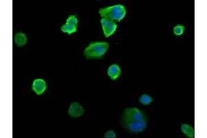 Immunofluorescence staining of MCF-7 cells with ABIN7151218 at 1:200, counter-stained with DAPI. (SIAH2 antibody  (AA 1-72))