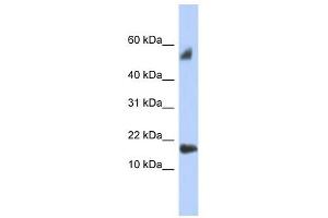 FLJ35767 antibody used at 1 ug/ml to detect target protein. (FLJ35767 (Middle Region) antibody)