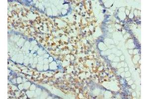 Immunohistochemistry of paraffin-embedded human small intestine tissue using ABIN7151389 at dilution of 1:100 (ENPP2 antibody  (AA 564-863))