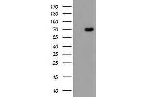 Western Blotting (WB) image for anti-Butyrylcholinesterase (BCHE) antibody (ABIN1496836) (Butyrylcholinesterase antibody)