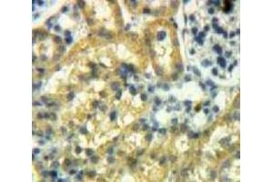 #VALUE! (SMAD2 antibody  (AA 272-467))