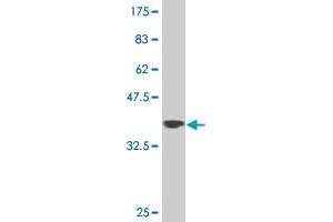 Western Blot detection against Immunogen (37. (ZNF281 antibody  (AA 787-893))