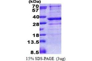 GIMAP5 Protein (AA 1-284) (His tag)