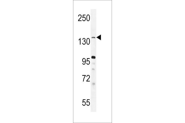 KDM3B antibody  (C-Term)