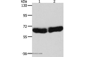 Western blot analysis of Human fetal liver and brain tissue, using CYP1B1 Polyclonal Antibody at dilution of 1:250 (CYP1B1 antibody)