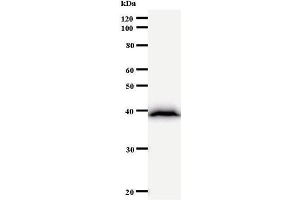 BAZ1B antibody