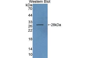 Detection of Recombinant GIF, Human using Polyclonal Antibody to Gastric Intrinsic Factor (GIF) (Intrinsic Factor antibody  (AA 198-413))