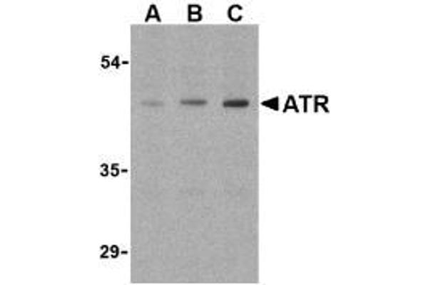 ANTXR1 antibody  (Internal Region)