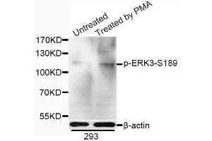 Western blot analysis of extracts of 293 cells, using Phospho-ERK3-S189 antibody (ABIN5969908) at 1/1000 dilution. (MAPK6 antibody  (pSer189))