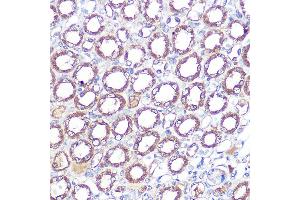 Immunohistochemistry of paraffin-embedded mouse kidney using ERK5 Rabbit mAb (ABIN1680723, ABIN3018327, ABIN3018328 and ABIN7101595) at dilution of 1:100 (40x lens). (MAPK7 antibody)