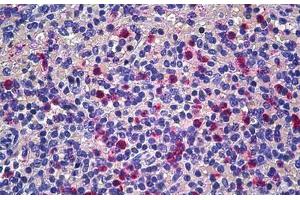 Human Spleen: Formalin-Fixed, Paraffin-Embedded (FFPE) (CD177 antibody  (AA 21-120))