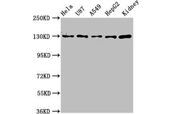 SLC12A2 antibody  (AA 110-282)