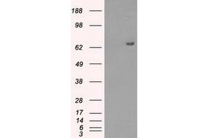 HEK293T cells were transfected with the pCMV6-ENTRY control (Left lane) or pCMV6-ENTRY HDAC10 (Right lane) cDNA for 48 hrs and lysed. (HDAC10 antibody)