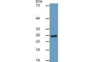 Western Blotting (WB) image for Granzyme M (Lymphocyte Met-Ase 1) (GZMM) ELISA Kit (ABIN6574157)