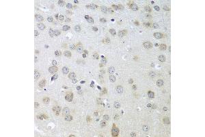 Immunohistochemistry of paraffin-embedded mouse brain using ACHE antibody at dilution of 1:100 (40x lens). (Acetylcholinesterase antibody)