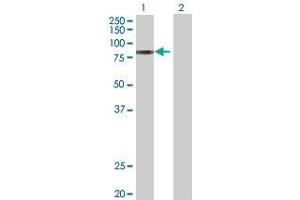 Lane 1: ADAM12 transfected lysate ( 81. (ADAM12 293T Cell Transient Overexpression Lysate(Denatured))