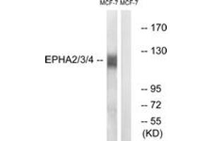 Western blot analysis of extracts from MCF-7 cells, using EPHA2/3/4 (Ab-588/596) Antibody. (EPHA2/3/4 antibody  (AA 556-605))