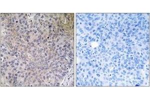 Immunohistochemistry (IHC) image for anti-NADH Dehydrogenase (Ubiquinone) Fe-S Protein 7, 20kDa (NADH-Coenzyme Q Reductase) (NDUFS7) (AA 164-213) antibody (ABIN2890440) (NDUFS7 antibody  (AA 164-213))