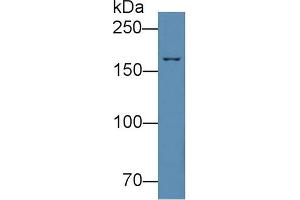 Detection of C4 in HepG2 cell lysate using Polyclonal Antibody to Complement Component 4 (C4) (Complement C4 antibody  (AA 1450-1723))