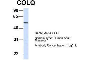 Host:  Rabbit  Target Name:  COLQ  Sample Type:  Human Adult Placenta  Antibody Dilution:  1. (COLQ antibody  (N-Term))