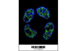 Confocal immunofluorescent analysis of FRAT2 Antibody with ZR-75-1 cell followed by Alexa Fluor 488-conjugated goat anti-rabbit lgG (green). (FRAT2 antibody  (C-Term))