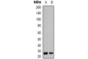 Western blot analysis of CD81 expression in U87MG (A), Ramos (B) whole cell lysates. (CD81 antibody)