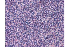 Immunohistochemistry (IHC) image for anti-Promyelocytic Leukemia (PML) (C-Term) antibody (ABIN404847) (PML antibody  (C-Term))
