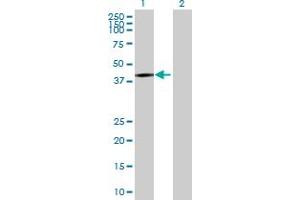 Lane 1: RP2 transfected lysate ( 38. (RP2 293T Cell Transient Overexpression Lysate(Denatured))