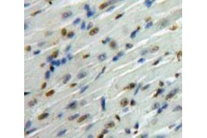 IHC-P analysis of Heart tissue, with DAB staining. (SMAD6 antibody  (AA 261-495))