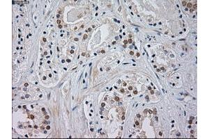 Immunohistochemistry (IHC) image for anti-Mitogen-Activated Protein Kinase 8 (MAPK8) (AA 1-384) antibody (ABIN1490768) (JNK antibody  (AA 1-384))