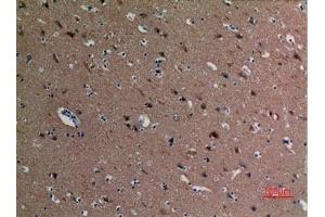 Immunohistochemical analysis of paraffin-embedded human-brain, antibody was diluted at 1:100. (alpha Tubulin antibody  (acLys40))