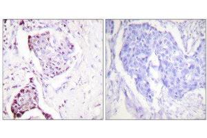 Immunohistochemistry (IHC) image for anti-Ubiquitin (Ubiquitin) (Internal Region) antibody (ABIN1848876) (Ubiquitin antibody  (Internal Region))