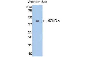 Western Blotting (WB) image for anti-Keratin 5 (KRT5) (AA 166-474) antibody (ABIN1172966) (Cytokeratin 5 antibody  (AA 166-474))