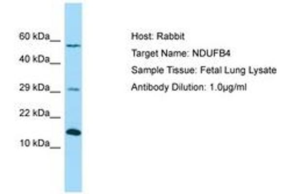 NDUFB4 antibody  (AA 71-120)