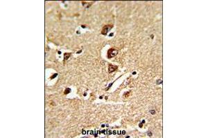 Formalin-fixed and paraffin-embedded human brain tissue reacted with GNPAT Antibody , which was peroxidase-conjugated to the secondary antibody, followed by DAB staining. (GNPAT antibody  (C-Term))