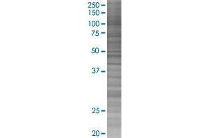 PPP1R2 transfected lysate. (PPP1R2 293T Cell Transient Overexpression Lysate(Denatured))