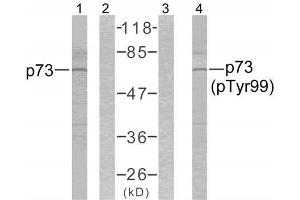 Western blot analysis of extracts from K562 cells using p73 (Ab-99) antibody (E021075, Lane1 and 2) and p73 (phospho-Tyr99) antibody (E011058, Lane 3 and 4). (Tumor Protein p73 antibody  (pTyr99))