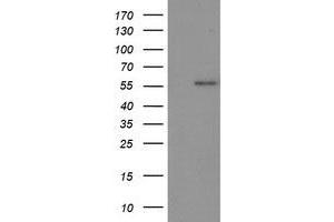 Western Blotting (WB) image for anti-Tumor Protein P53 (TP53) antibody (ABIN1499978) (p53 antibody)