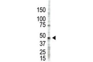 Western Blotting (WB) image for anti-Protein Arginine Methyltransferase 2 (PRMT2) antibody (ABIN2995499) (PRMT2 antibody)