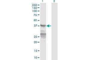 Western Blot analysis of CNN3 expression in transfected 293T cell line by CNN3 monoclonal antibody (M01), clone 4C4. (CNN3 antibody  (AA 1-329))
