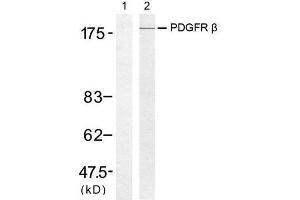 Western blot analysis of extract from 293 cells, using PDGF Receptor β (Ab-751) antibody (E021219). (PDGFRB antibody)