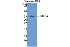 Western blot analysis of the recombinant protein. (LGI3 antibody  (AA 261-548))