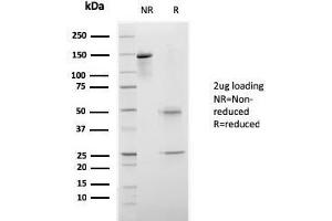 SDS-PAGE Analysis Purified CELA3B Recombinant Mouse Monoclonal Antibody (rCELA3B/1811). (Recombinant Elastase 3B antibody  (AA 82-238))