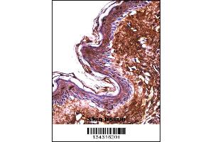 PPT2 Antibody immunohistochemistry analysis in formalin fixed and paraffin embedded human skin tissue followed by peroxidase conjugation of the secondary antibody and DAB staining. (PPT2 antibody  (AA 183-212))