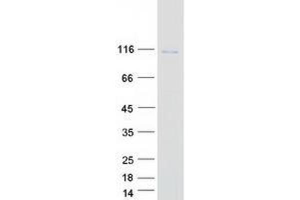 VPS41 Protein (Transcript Variant 1) (Myc-DYKDDDDK Tag)